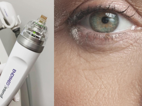 EndyMed PRO Intensif