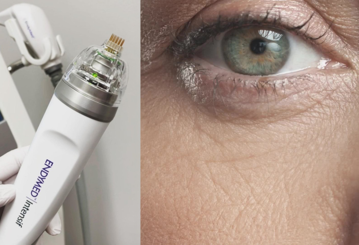 EndyMed PRO Intensif