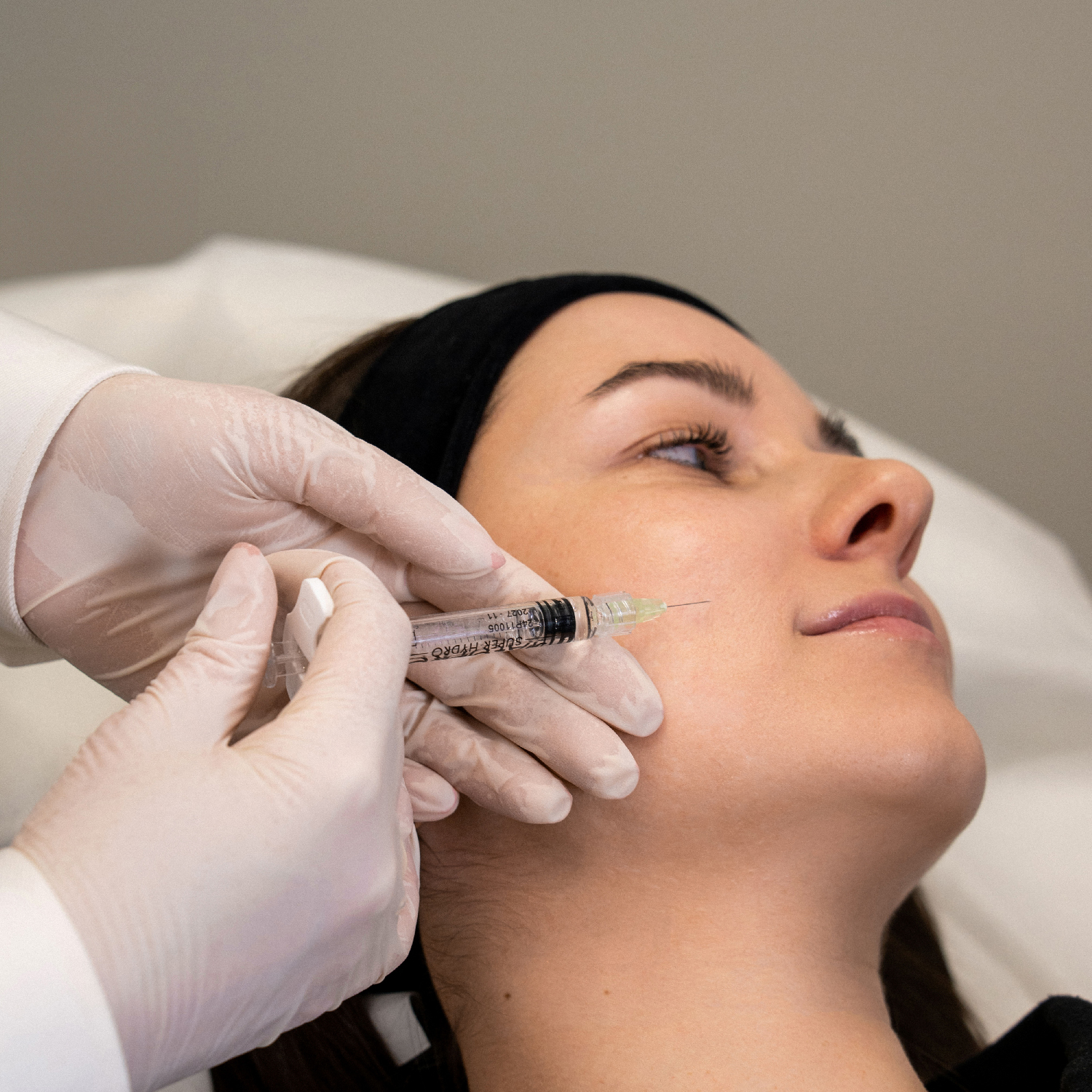 Pykčio raukšlė (tarp antakių)