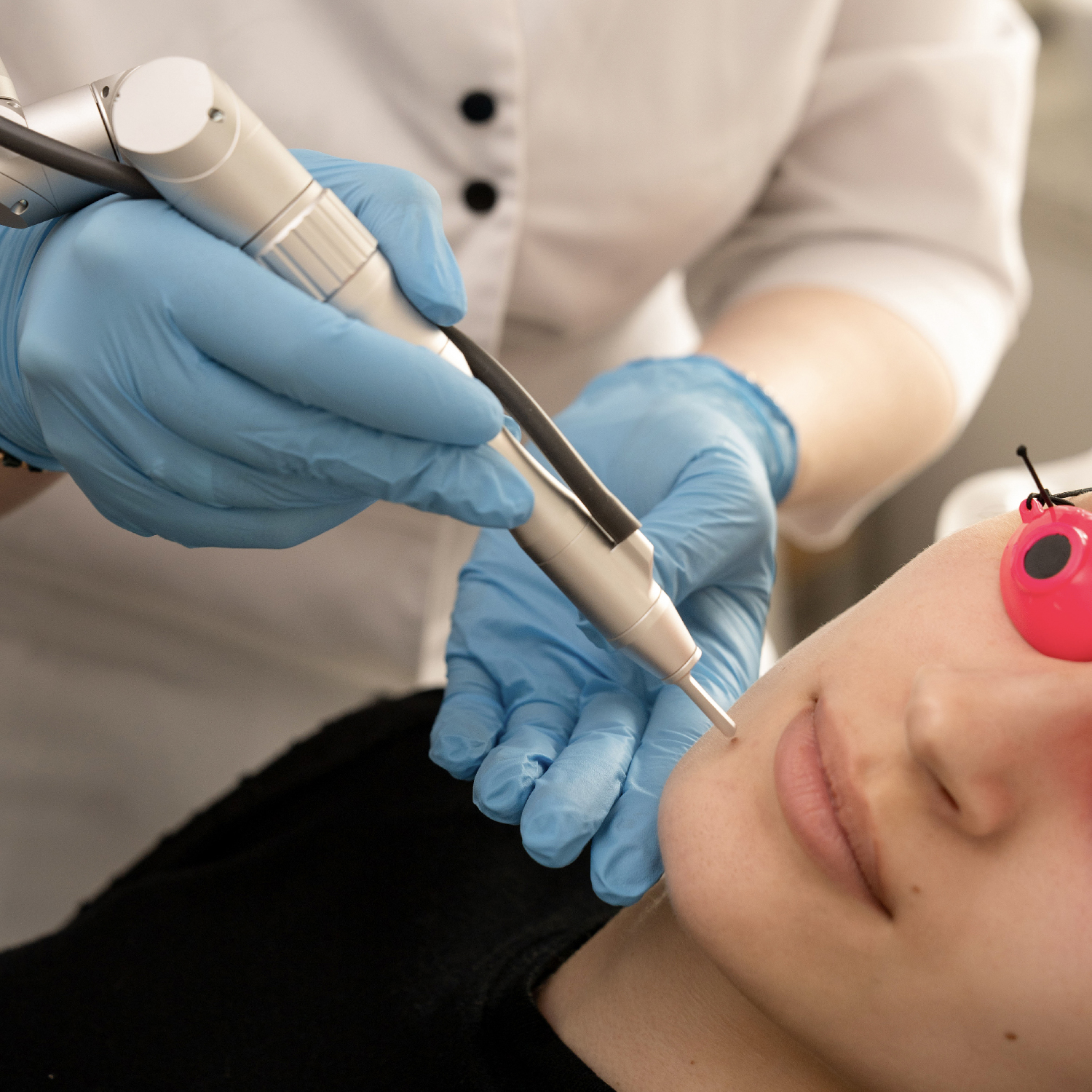 Aparatinės procedūros, kurias atlieka gydytojai dermatovenerologai