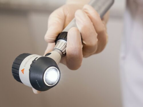 Odos darinių apžiūra dermatoskopu