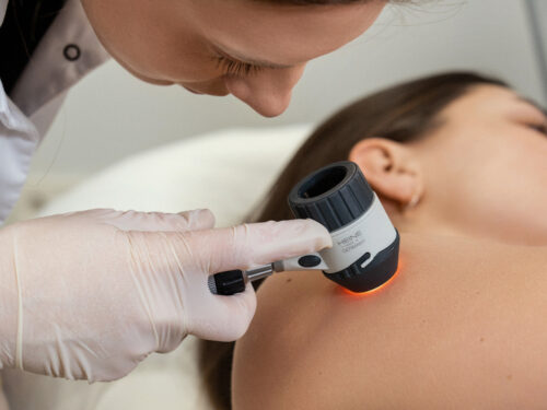 Gydytojo dermatologo konsultacija Kaune