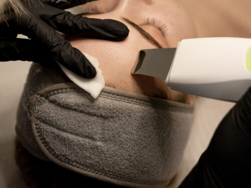 Veido valymas (mechaninis, rūgštinis, ultragarsinis)